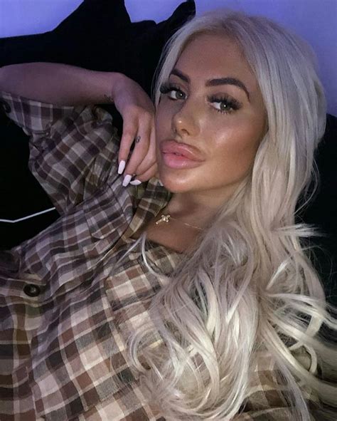 chloe ferry plastic surgery timeline.